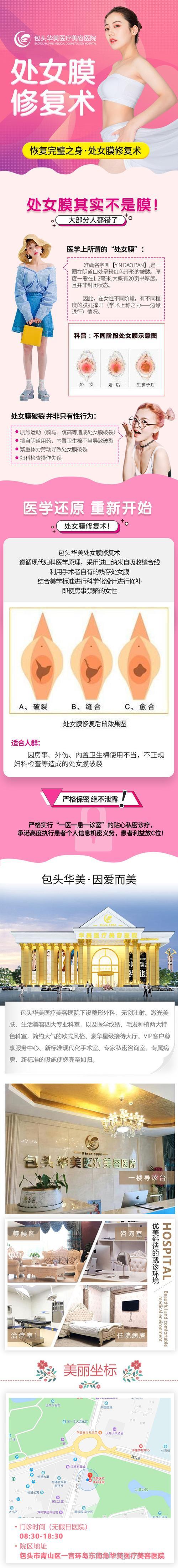 韩式处女膜修补术介绍