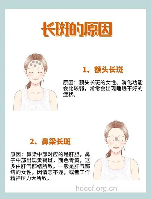 人的脸上为什么会长斑？