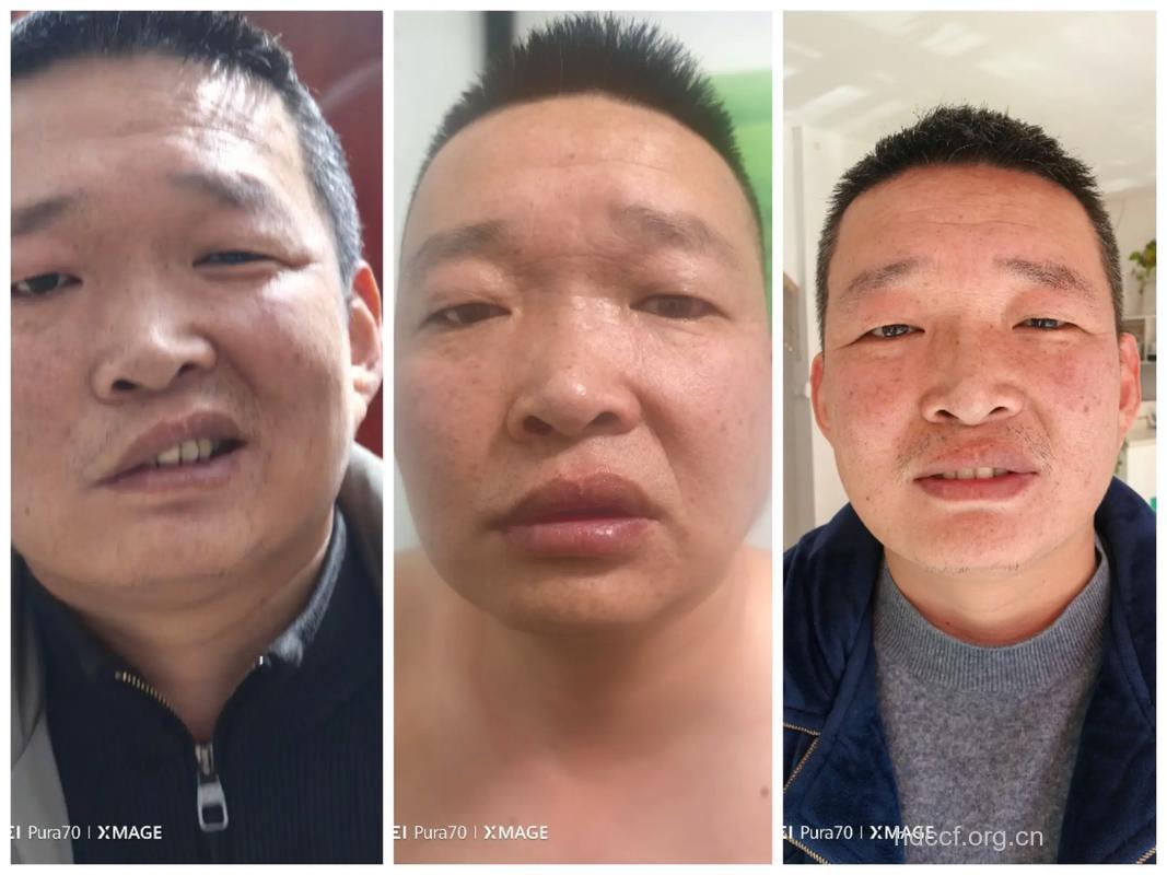 男人脸色差难调理 内外结合效果好