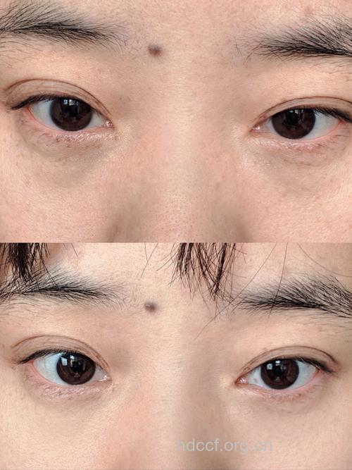 扔掉眼袋，挑战美眸达人
