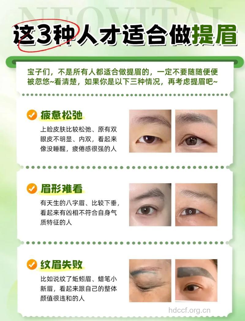 提眉术的三大功效
