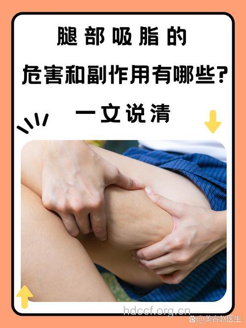 大腿吸脂会出现哪些副作用