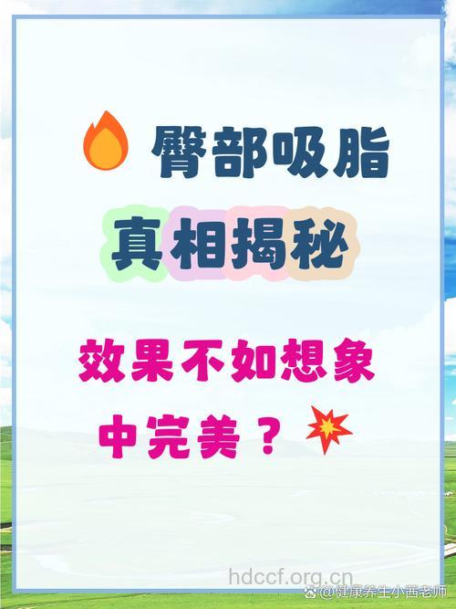 臀部吸脂减肥法的优势