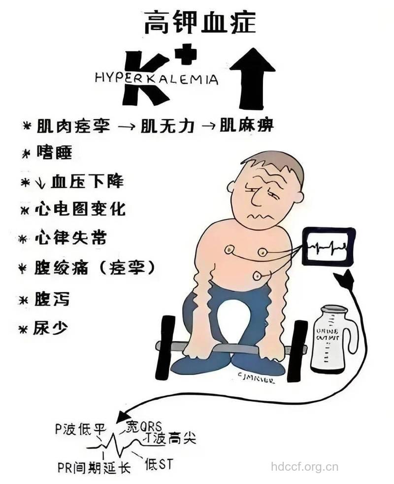 尿毒症为什么会导致高血钾症