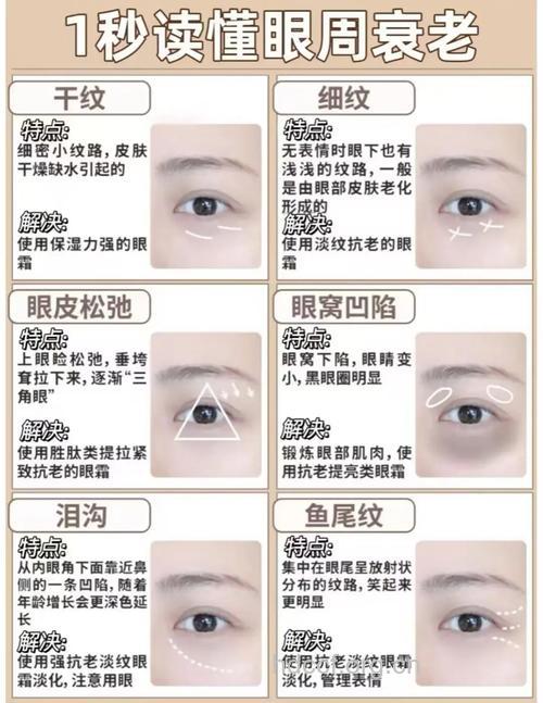 眼部除皱有哪些方法