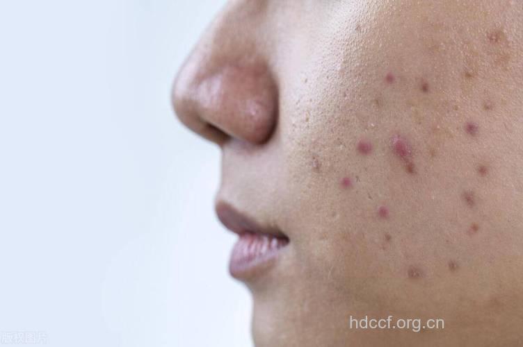 男性内分泌失调的4个常见症状