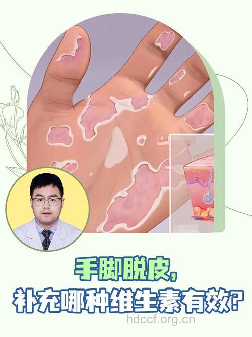 手脚脱皮补充营养元素