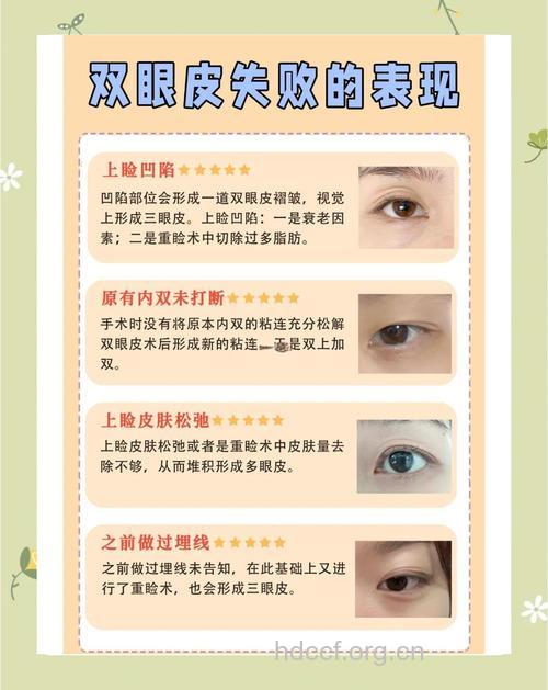 影响双眼皮手术效果的原因有哪些