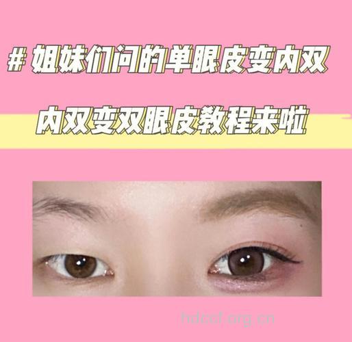 内双怎么选择割双眼皮的方法