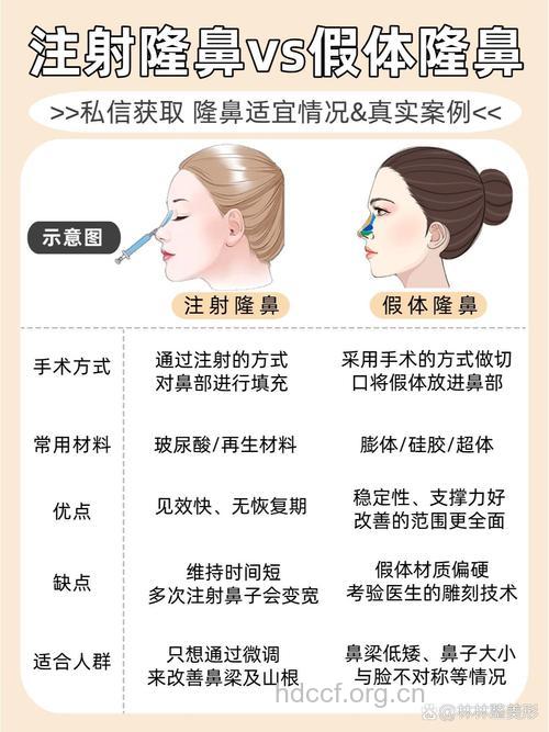 玻尿酸隆鼻有什么手术优点