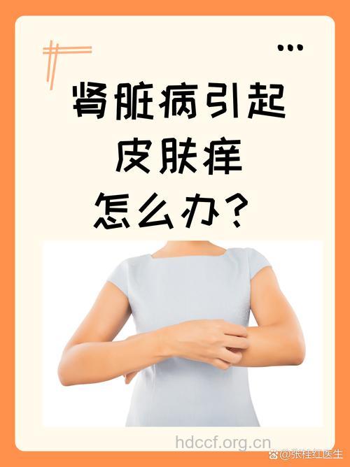 皮肤瘙痒可能是肾病的入侵