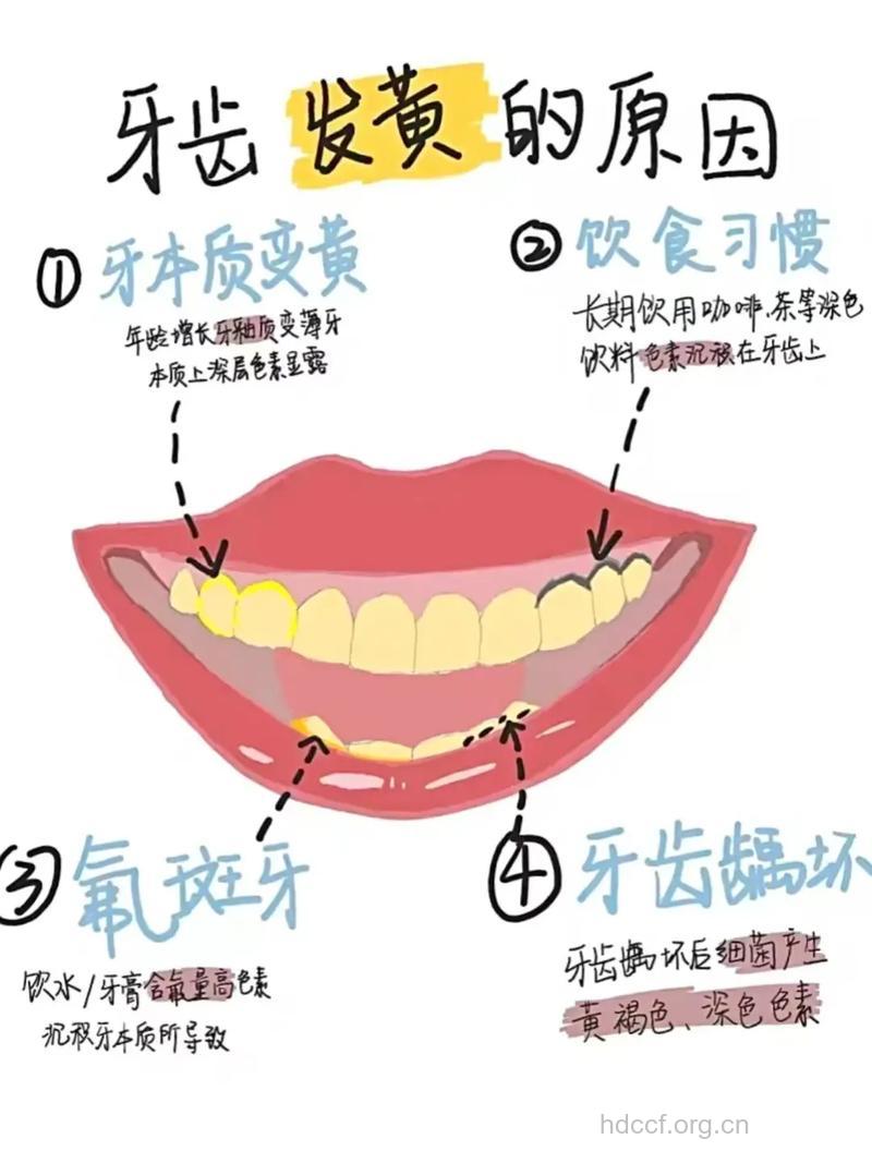 如何应对满口的大黄牙呢？