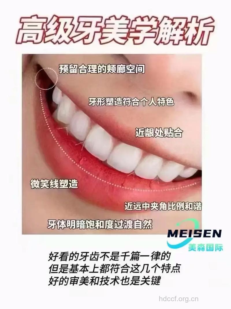 “美容冠”美齿术有哪些优点