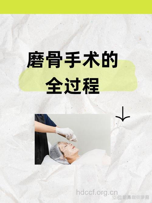 颧骨整形颧骨缩小术的手术方法