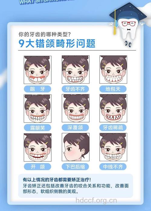 说说牙齿整形的那一点事