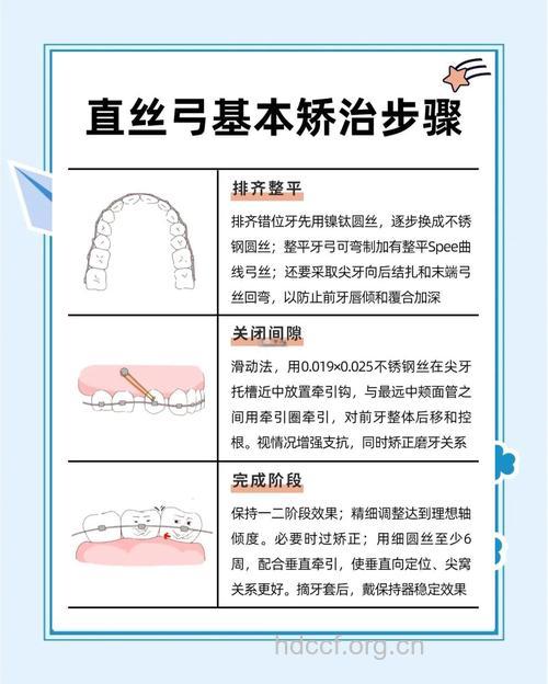 MBT直丝弓隐形正畸技术为什么那么受欢迎