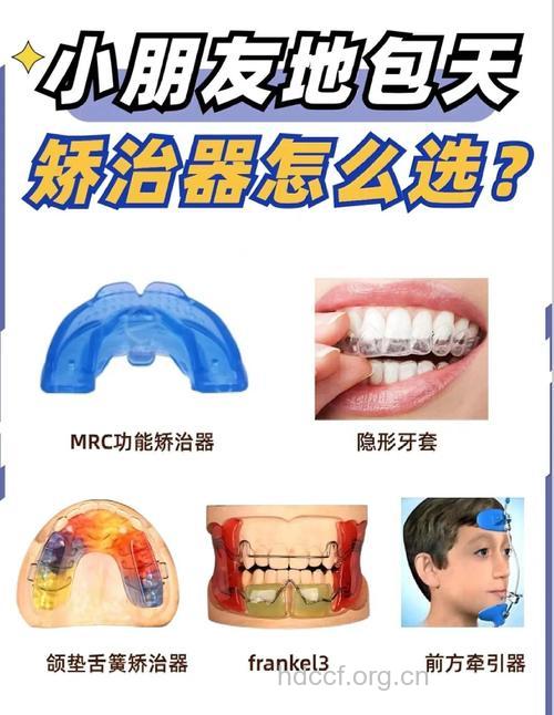 牙齿“地包天”矫正需趁早