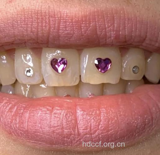 哪些人适合用水晶牙饰美容