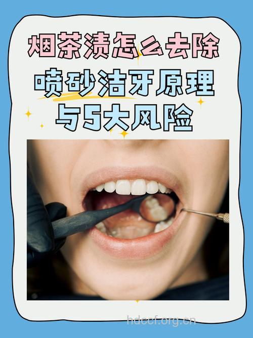 喷砂洗牙的效果如何