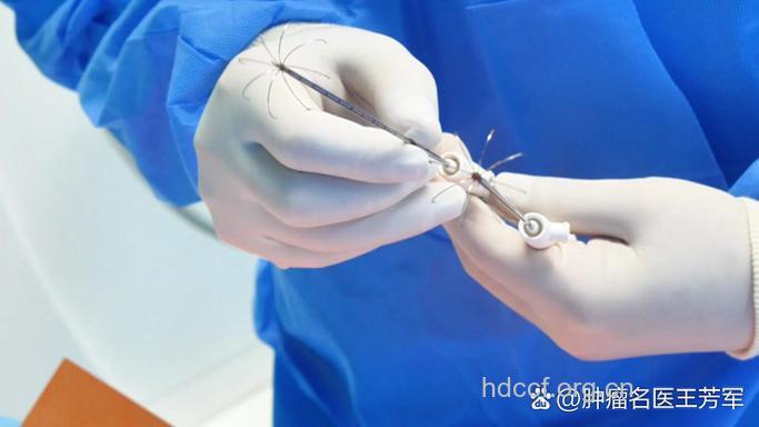 韩式微创法有哪些特点