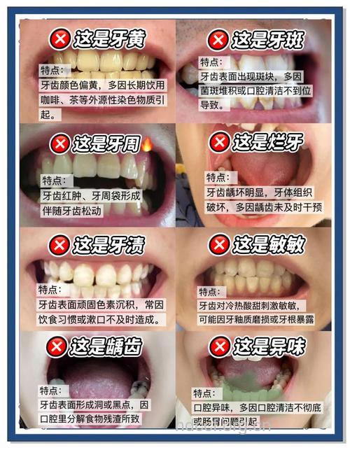 牙齿美白有哪些常见问题