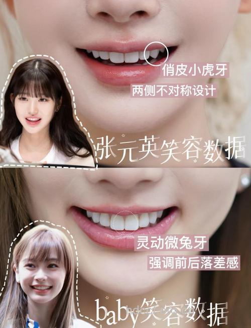 看看你是否需要做牙齿整容