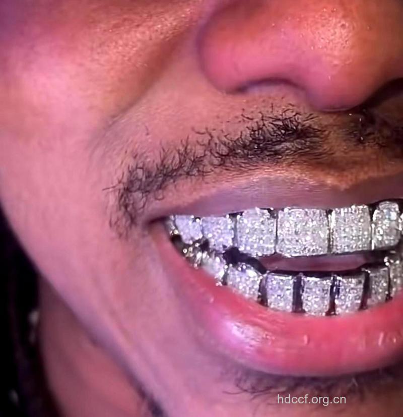 把钻石镶在牙齿会怎么样呢