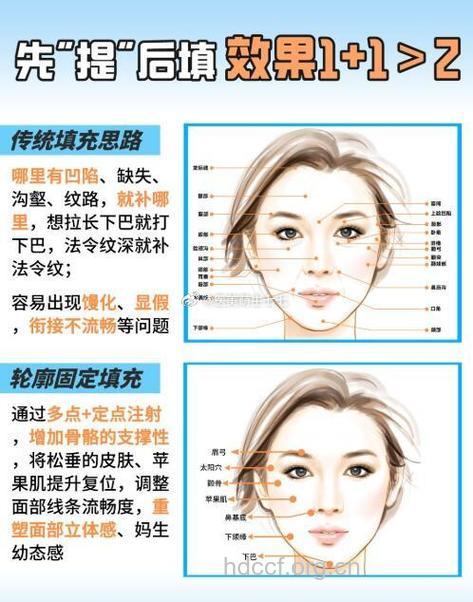 什么是三点弧改脸型