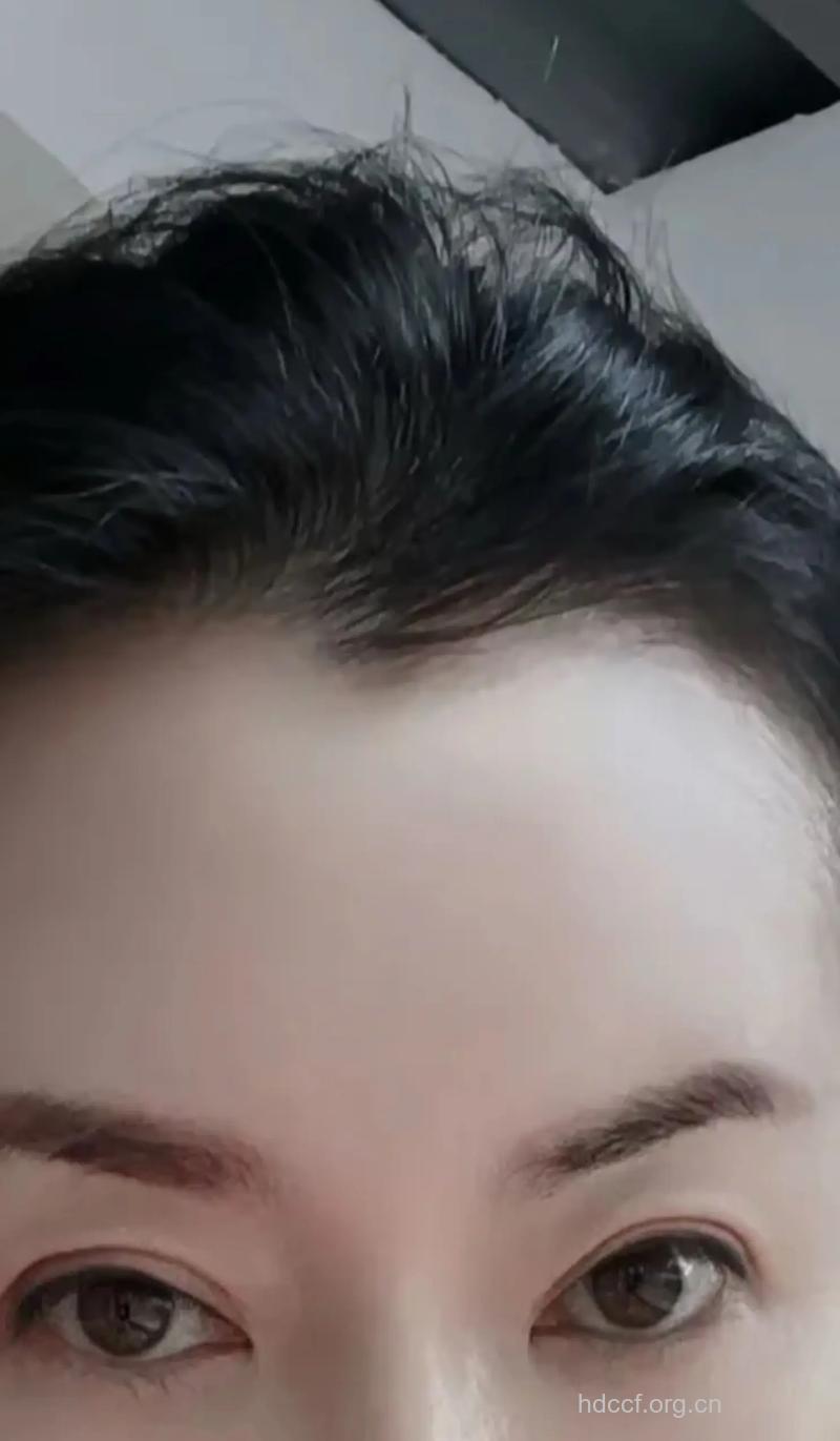 怎样才能拥“美人尖”