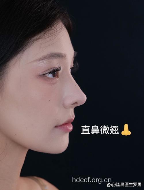 东方人隆鼻的目地有哪些