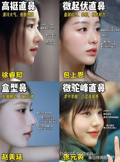 韩式隆鼻有哪些标准