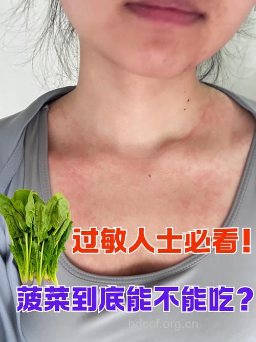 哪些蔬菜会引起皮肤发炎