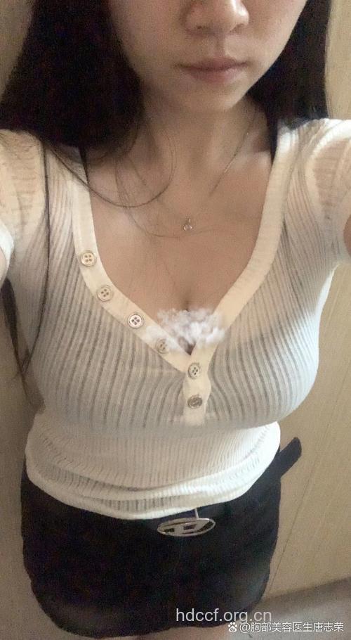 女网友为隆胸网上求助