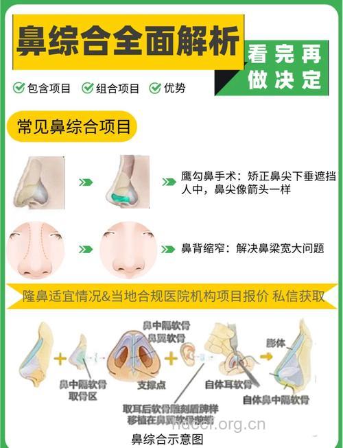 全面解析隆鼻术