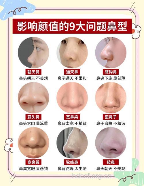 鼻子的常见问题有哪些