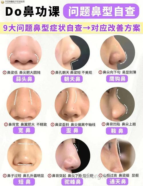 隆鼻手术的原则是什么
