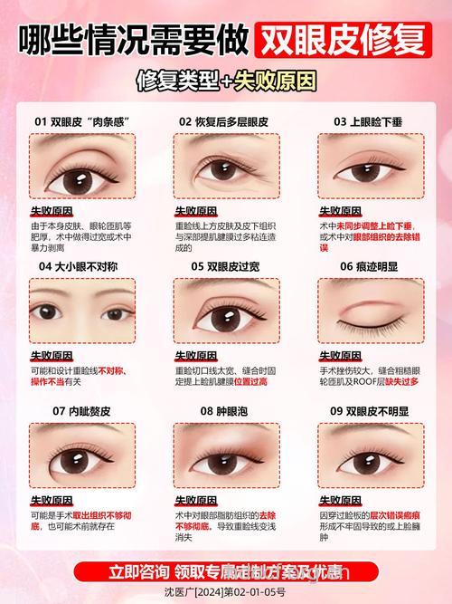双眼皮修复要注意些什么