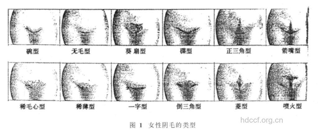 女性阴部怎么脱毛最好