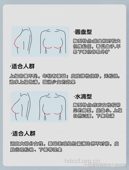 解析三种隆胸术的优缺点