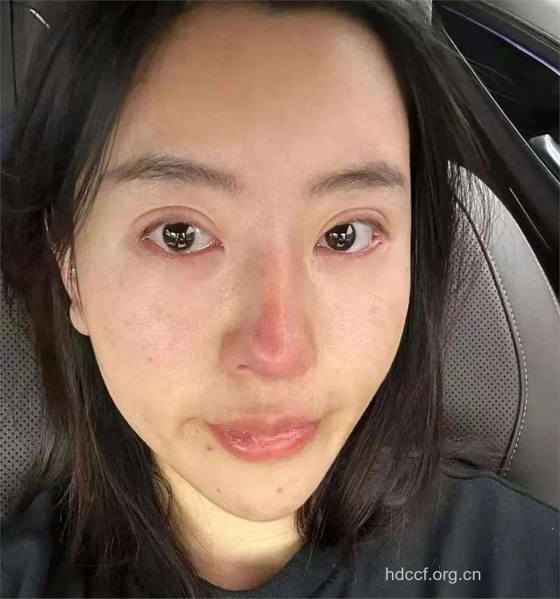 国字脸女生的烦恼