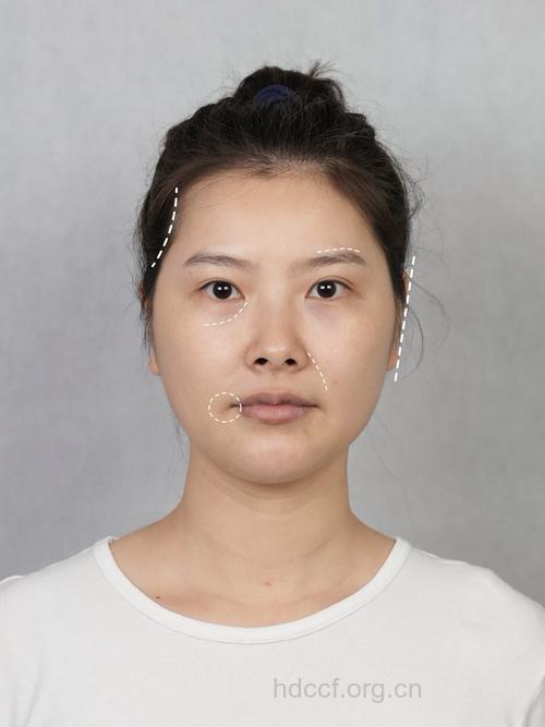 韩式脸型的修整有哪些特点
