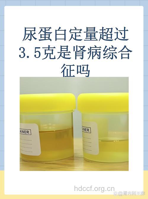 英研究称:苏打粉可延缓慢肾者肾退化进程