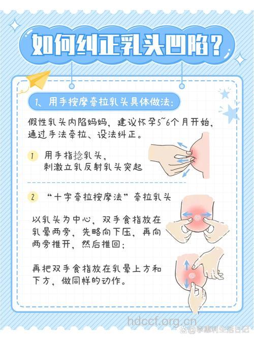 乳头内陷有哪些手术矫正法