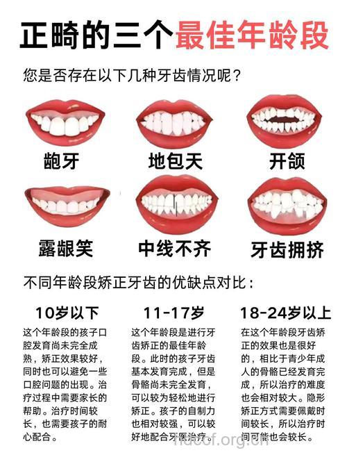 牙齿矫正的最佳年龄