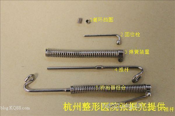 ForsusTM 抗折型直接推杆式矫治器的优点