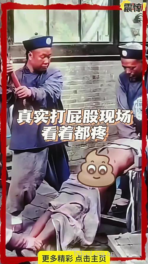 打屁股打来急性肾衰