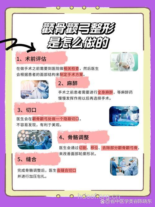 怎么进行颧骨整形手术