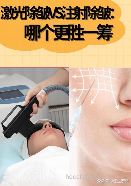 像束激光怎么除皱方法