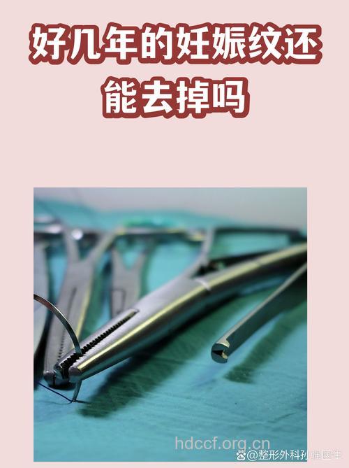 哪些整形方法可祛除妊娠纹