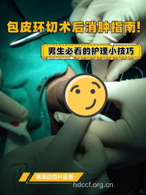 孩子的包皮是否需要手术环切呢?